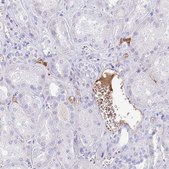 Anti-IGF1 antibody produced in rabbit Prestige Antibodies® Powered by Atlas Antibodies, affinity isolated antibody, buffered aqueous glycerol solution