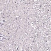 Anti-IL18BP antibody produced in rabbit Prestige Antibodies® Powered by Atlas Antibodies, affinity isolated antibody, buffered aqueous glycerol solution