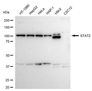 Anti STAT2 Antibody, clone 24GB2095, Rabbit Monoclonal clone 24GB2095, recombinant rabbit monoclonal, expressed in HEK293 cells