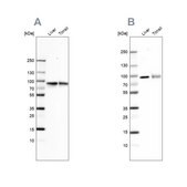 Anti-TF antibody produced in rabbit Ab1, Prestige Antibodies® Powered by Atlas Antibodies, affinity isolated antibody, buffered aqueous glycerol solution