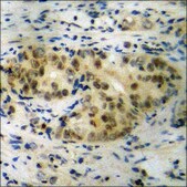 Anti-phospho-TNNI3 (pSer22+Ser23) antibody produced in rabbit affinity isolated antibody