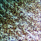 Anti-phospho-NMDAR2B (pTyr1336) antibody produced in rabbit affinity isolated antibody