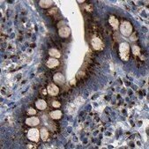 Anti-TGOLN2 antibody produced in rabbit Prestige Antibodies® Powered by Atlas Antibodies, affinity isolated antibody, buffered aqueous glycerol solution