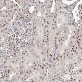 Anti-WRAP53 antibody produced in rabbit Prestige Antibodies® Powered by Atlas Antibodies, affinity isolated antibody, buffered aqueous glycerol solution