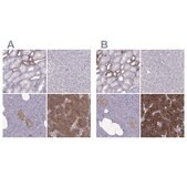 Anti-CASR antibody produced in rabbit Prestige Antibodies® Powered by Atlas Antibodies, affinity isolated antibody, buffered aqueous glycerol solution