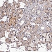 Anti-TNN antibody produced in rabbit Prestige Antibodies® Powered by Atlas Antibodies, affinity isolated antibody, buffered aqueous glycerol solution, ab2