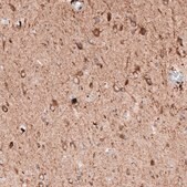 Monoclonal Anti-LAPTM4B antibody produced in mouse Prestige Antibodies® Powered by Atlas Antibodies, clone CL5289, purified immunoglobulin, buffered aqueous glycerol solution