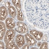 Anti-PEBP1 antibody produced in rabbit Prestige Antibodies® Powered by Atlas Antibodies, affinity isolated antibody, buffered aqueous glycerol solution