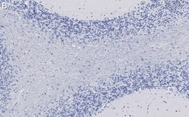 Anti-CNPase Antibody, clone 3N12 ZooMAb® Rabbit Monoclonal recombinant, expressed in HEK 293 cells