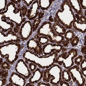 Anti-CSN3 antibody produced in rabbit Prestige Antibodies® Powered by Atlas Antibodies, affinity isolated antibody, buffered aqueous glycerol solution