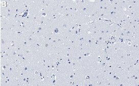 Anti-MCAM/CD146 Antibody, clone 1C21 ZooMAb® Rabbit Monoclonal recombinant, expressed in HEK 293 cells
