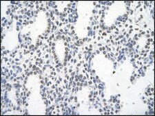 Anti-FOSL1 affinity isolated antibody