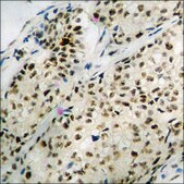 Anti-phospho-MEF2A (pThr312) antibody produced in rabbit affinity isolated antibody