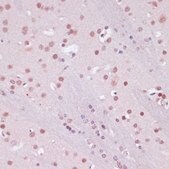 Anti- KDM1 antibody produced in rabbit