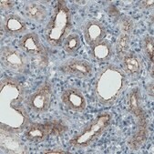 Monoclonal Anti-OCLN antibody produced in mouse Prestige Antibodies® Powered by Atlas Antibodies, clone CL1567, purified immunoglobulin, buffered aqueous glycerol solution