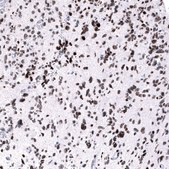 Monoclonal Anti-EZH2 antibody produced in mouse Prestige Antibodies® Powered by Atlas Antibodies, clone CL11945, purified immunoglobulin, buffered aqueous glycerol solution