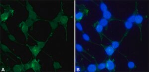 Anti-Sprouty 2 (N-Terminal) from rabbit affinity isolated antibody, buffered aqueous solution