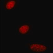 单克隆抗 增殖细胞蛋白 Ki-67 小鼠抗 clone PP-67, ascites fluid