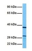 Anti-SLC25A4 affinity isolated antibody