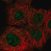 Anti-RAD50 antibody produced in rabbit Prestige Antibodies® Powered by Atlas Antibodies, affinity isolated antibody, buffered aqueous glycerol solution
