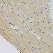 Anti- TTC11/FIS1 antibody produced in rabbit