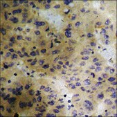 抗 磷酸化 PLK1 (pThr 210 ) 兔抗 affinity isolated antibody