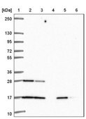 Anti-RALA antibody produced in rabbit Prestige Antibodies® Powered by Atlas Antibodies, affinity isolated antibody, buffered aqueous glycerol solution