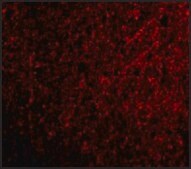 Anti-TSLP (ab2) antibody produced in rabbit affinity isolated antibody, buffered aqueous solution