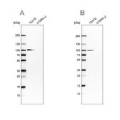 Anti-UFL1 antibody produced in rabbit Prestige Antibodies® Powered by Atlas Antibodies, affinity isolated antibody, buffered aqueous glycerol solution, ab3
