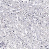 Anti-MGAM antibody produced in rabbit Prestige Antibodies® Powered by Atlas Antibodies, affinity isolated antibody, buffered aqueous glycerol solution