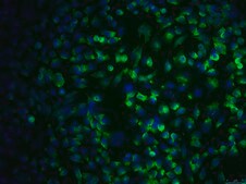 SCp2 Mouse Mammary Epithelial Cell Line