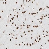 Anti-HNRNPK antibody produced in rabbit Prestige Antibodies® Powered by Atlas Antibodies, affinity isolated antibody, buffered aqueous glycerol solution