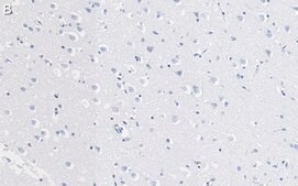 Anti-Prion Protein Antibody, clone 3F17 ZooMAb® Rabbit Monoclonal recombinant, expressed in HEK 293 cells