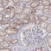 Anti-PTH1R antibody produced in rabbit Prestige Antibodies® Powered by Atlas Antibodies, affinity isolated antibody, buffered aqueous glycerol solution