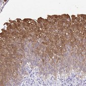 Anti-IDH1 antibody produced in rabbit Prestige Antibodies® Powered by Atlas Antibodies, affinity isolated antibody, buffered aqueous glycerol solution