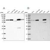 Anti-GBE1 antibody produced in rabbit Prestige Antibodies® Powered by Atlas Antibodies, affinity isolated antibody, buffered aqueous glycerol solution
