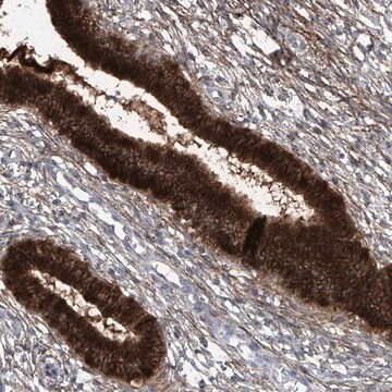 Anti-TXNIP antibody produced in rabbit Prestige Antibodies® Powered by Atlas Antibodies, affinity isolated antibody, buffered aqueous glycerol solution