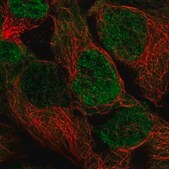 Anti-PSMD3 antibody produced in rabbit Prestige Antibodies® Powered by Atlas Antibodies, affinity isolated antibody, buffered aqueous glycerol solution