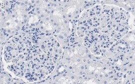 Anti-Wilms Tumor Protein Antibody, clone 2O18 ZooMAb® Rabbit Monoclonal recombinant, expressed in HEK 293 cells