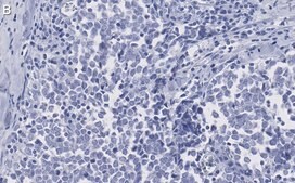 Anti-Myogenin Antibody, clone 1M17 ZooMAb® Rabbit Monoclonal recombinant, expressed in HEK 293 cells