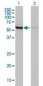 Monoclonal Anti-CBS antibody produced in mouse clone 3E1, purified immunoglobulin, buffered aqueous solution