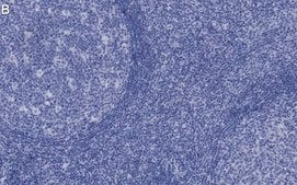 Anti-Syk Antibody, clone 2G22 ZooMAb® Rabbit Monoclonal recombinant, expressed in HEK 293 cells