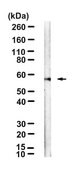 Anti-TRIM8 Antibody, clone 1I18 ZooMAb® Rabbit Monoclonal recombinant, expressed in HEK 293 cells