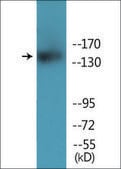 Anti-phospho-HER3 (pTyr1222) antibody produced in rabbit affinity isolated antibody