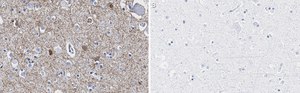 Anti-GAD65 Antibody, clone 3B23 ZooMAb® Rabbit Monoclonal recombinant, expressed in HEK 293 cells
