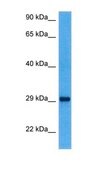 Anti-YWHAQ antibody produced in rabbit affinity isolated antibody