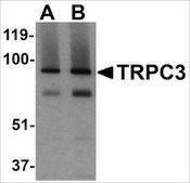 Anti-TRPC3 (ab3) antibody produced in rabbit affinity isolated antibody, buffered aqueous solution