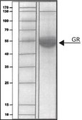 谷胱甘肽还原酶 人 buffered aqueous solution, ≥10 units/mg protein, recombinant, expressed in E. coli