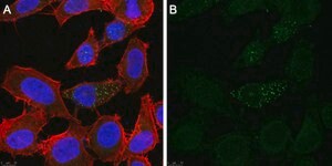 Anti-Tie-2 Antibody, clone 1C5 ZooMAb® Rabbit Monoclonal recombinant, expressed in HEK 293 cells