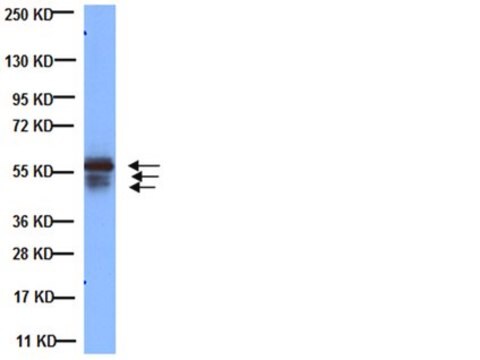 Anti-Cytokeratin AE1/AE3 Antibody, recognizes acidic &amp; basic cytokeratins, clone AE1/AE3 clone AE1/AE3, Chemicon&#174;, from mouse